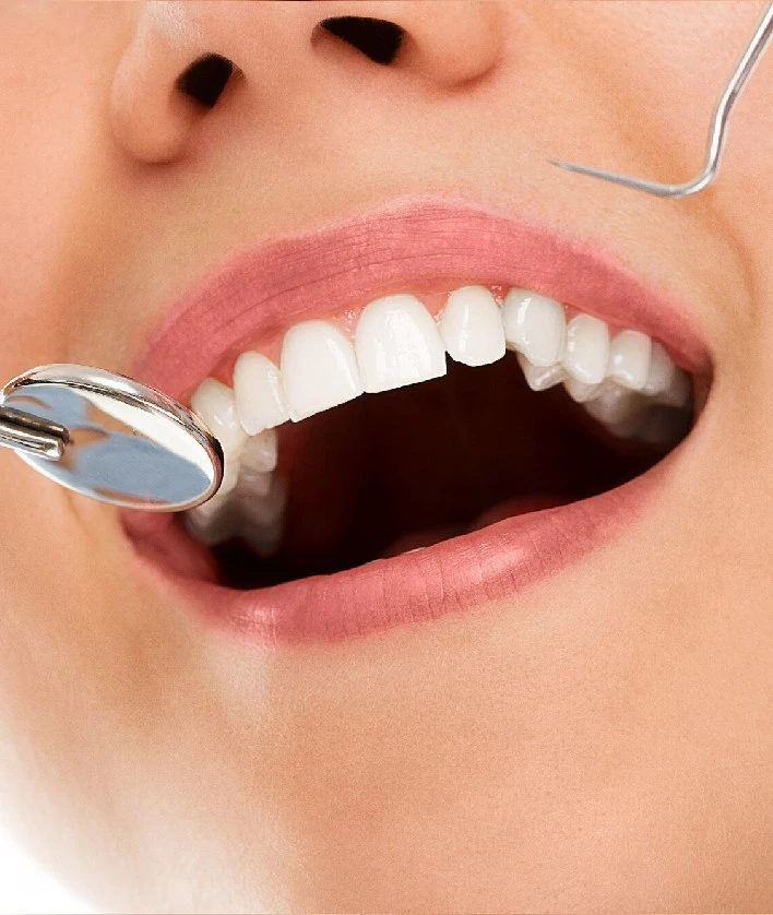 Dental examination with mirror tool during oral check-up at Smile Center Turkey