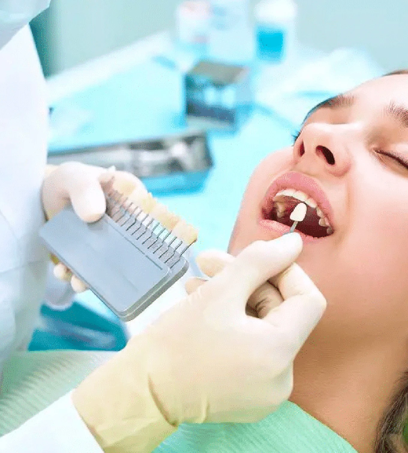 Laminate Veneers Procedure